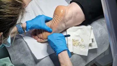 Podologia i Kosmetologia mgr Anna Natalia Skrzypczak Podolog Kołobrzeg